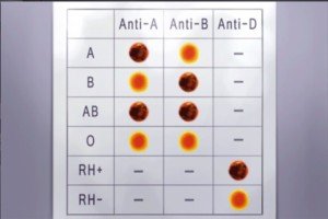 DR 3-7 Blood Result Chart